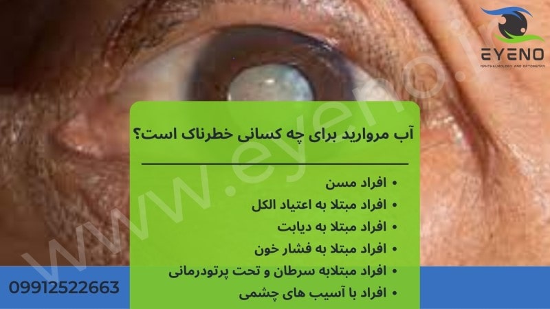 خطرات آب مروارید