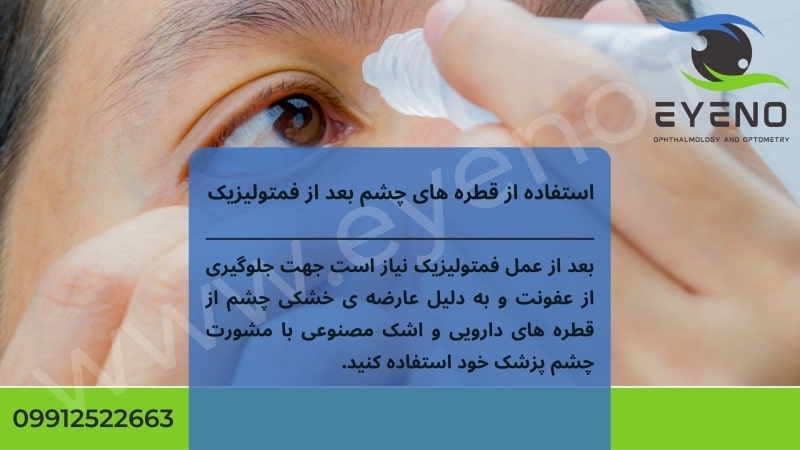 استفاده ز قطره های چشم بعد از فمتولیزیک